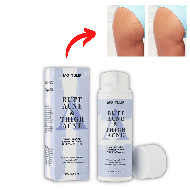 Creme para Eliminar Manchas e Acne - Tulip 100 Ml